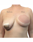 Bring It Up Clear Breast Shaper C/D before and after